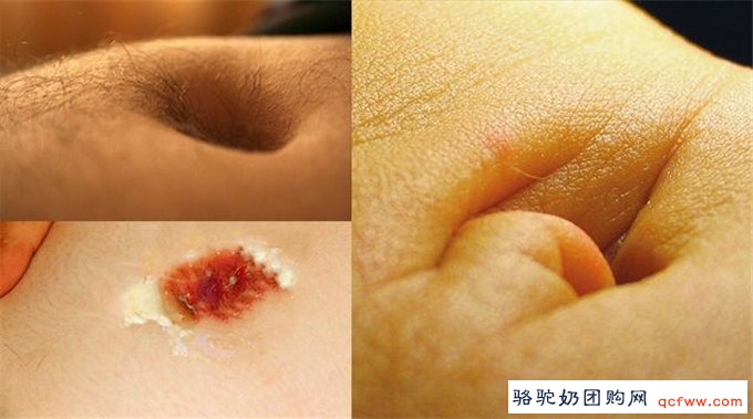 腹部望诊识病症
