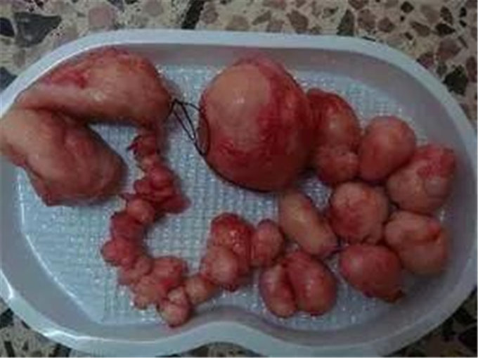 21岁女大学生，腹大如鼓，男友责问，哭说自己没有对不起他