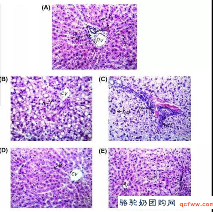 骆驼乳治疗酒精性肝损伤的研究